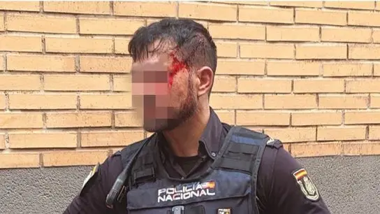 Un agente de la Polic&iacute;a Nacional sufre un traumatismo craneoencef&aacute;lico y seis puntos de sutura al ser agredido con una estaca en Murcia (foto: JUPOL)