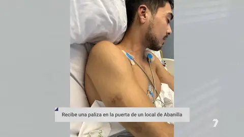 Agredido tras dar un concierto en Abanilla