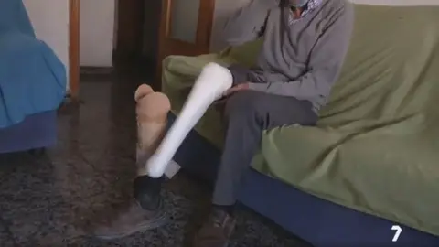 Hombre en Espinardo con la pierna amputada