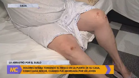 Dolores nos ense&ntilde;a parte de las heridas sufridas tras ser arrastrada por un joven en Cieza (foto: La 7)