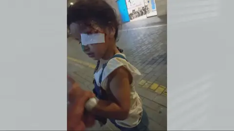 Foto de la peque&ntilde;a mordida por un perro en Murcia tras ser intervenida en la Arrixaca (foto: La 7)