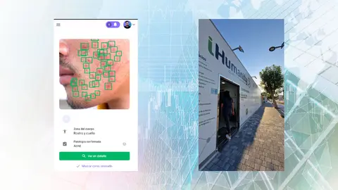 Los centros m&eacute;dicos iHumanity implementan un servicio especializado de dermatolog&iacute;a con Inteligencia Artificial
