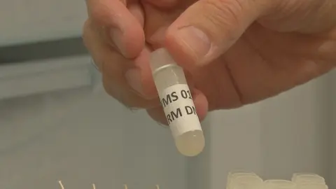 Muestra de semen de una cl&iacute;nica de inseminaci&oacute;n artificial (foto: La 7)