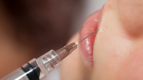 Los peligros de la obsesi&oacute;n de la belleza: se multiplican los pacientes que se han hecho 'destrozos' con &aacute;cido hialur&oacute;nico sin supervisi&oacute;n