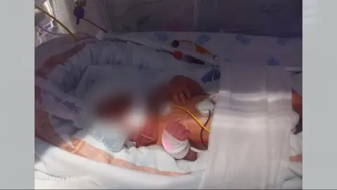 El peque&ntilde;o ilorcitano Jos&eacute; vive conectado a una m&aacute;quina del hospital 12 de octubre de Madrid (foto: La 7)