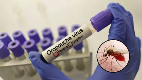 Virus Oropouche