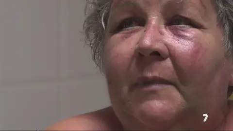 Antonia, afectada por el robo con violencia en su vivienda en Puerto Lumbreras