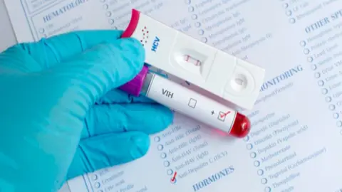 Test de detecci&oacute;n de VIH