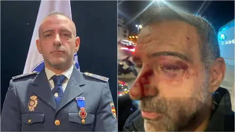 Gabriel, el agente agredido con un casco integral por un repartidor a domicilio (foto: El Espa&ntilde;ol)