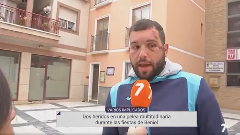 El herido en la reyerta