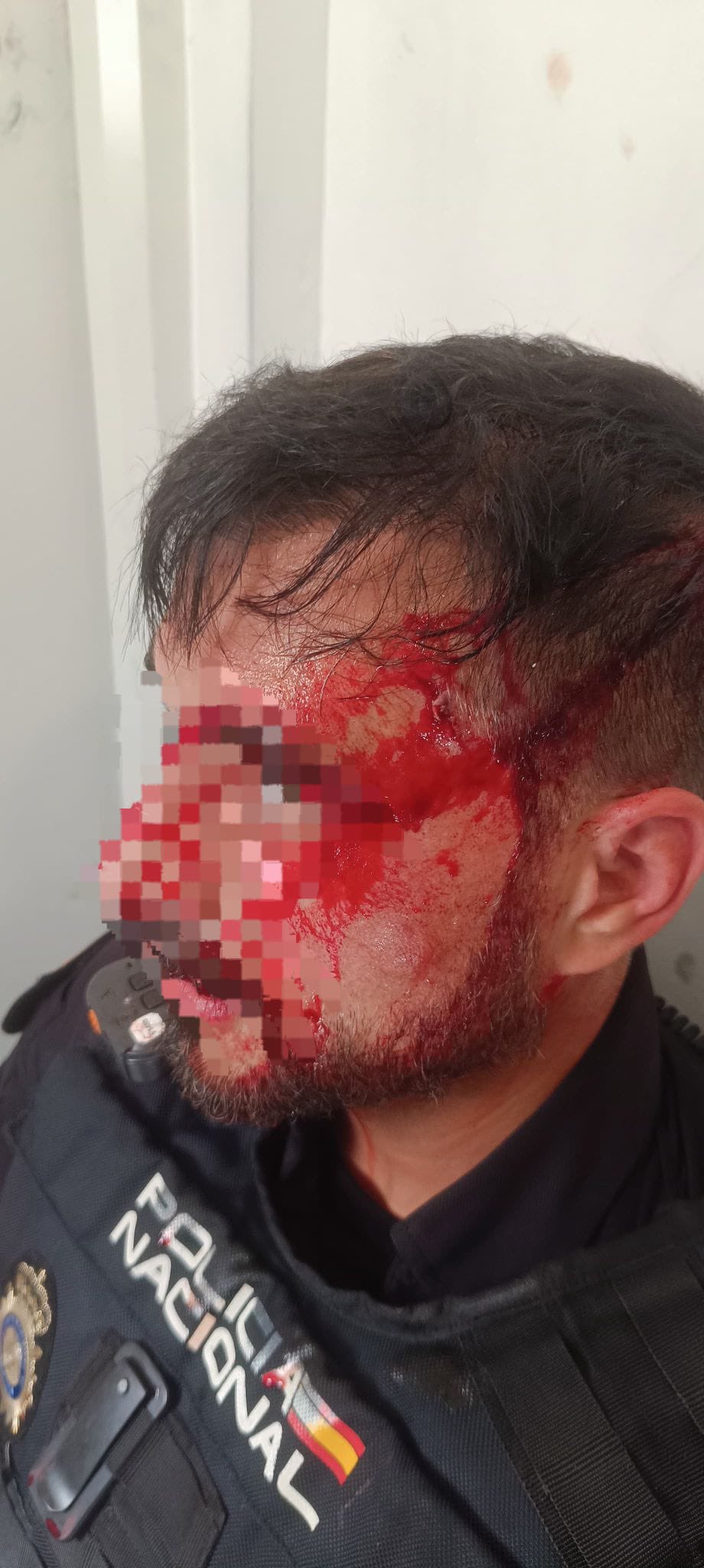 Un agente de la Policía Nacional sufre un traumatismo craneoencefálico y seis puntos de sutura al ser agredido con una estaca en Murcia (foto: JUPOL)